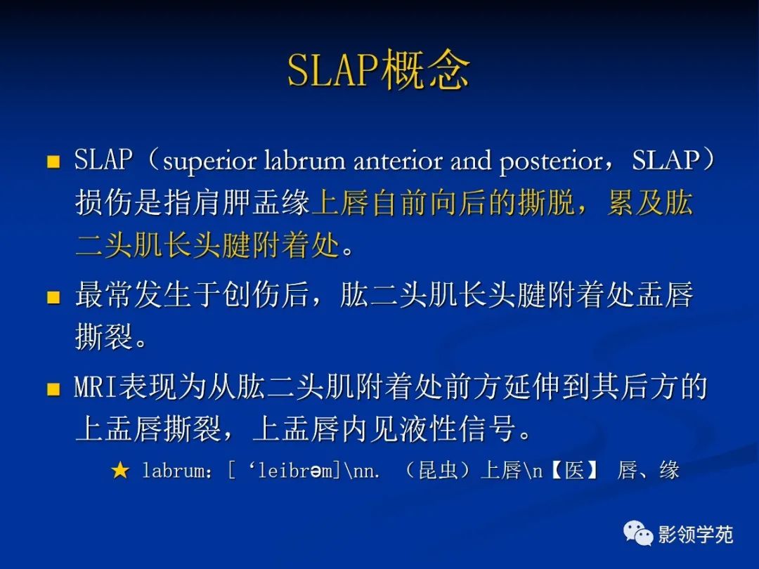 影像PPT - 【PPT】肩关节盂唇损伤的MRI诊断-37 影像PPT - 【PPT】肩关节盂唇损伤的MRI诊断-37