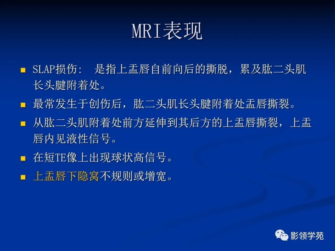 影像PPT - 【PPT】肩关节盂唇损伤的MRI诊断-52 影像PPT - 【PPT】肩关节盂唇损伤的MRI诊断-52