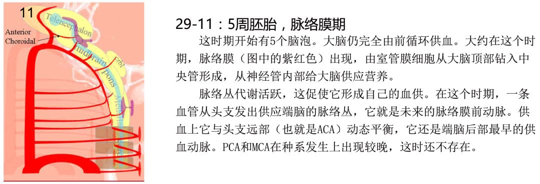 影像PPT - 从解剖到临床——认识脉络膜前动脉-1 影像PPT - 从解剖到临床——认识脉络膜前动脉-1