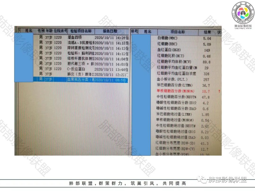 影像PPT - 【病例】肺结核还是肺癌?——善恶难辨-4 影像PPT - 【病例】肺结核还是肺癌?——善恶难辨-4
