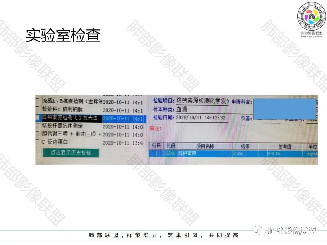 影像PPT - 【病例】肺结核还是肺癌?——善恶难辨-3 影像PPT - 【病例】肺结核还是肺癌?——善恶难辨-3