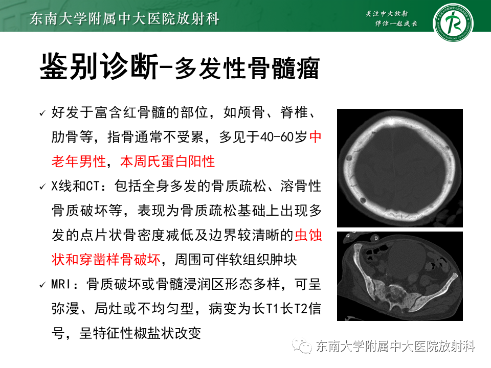 影像PPT - 【PPT】肾性骨营养不良-32 影像PPT - 【PPT】肾性骨营养不良-32