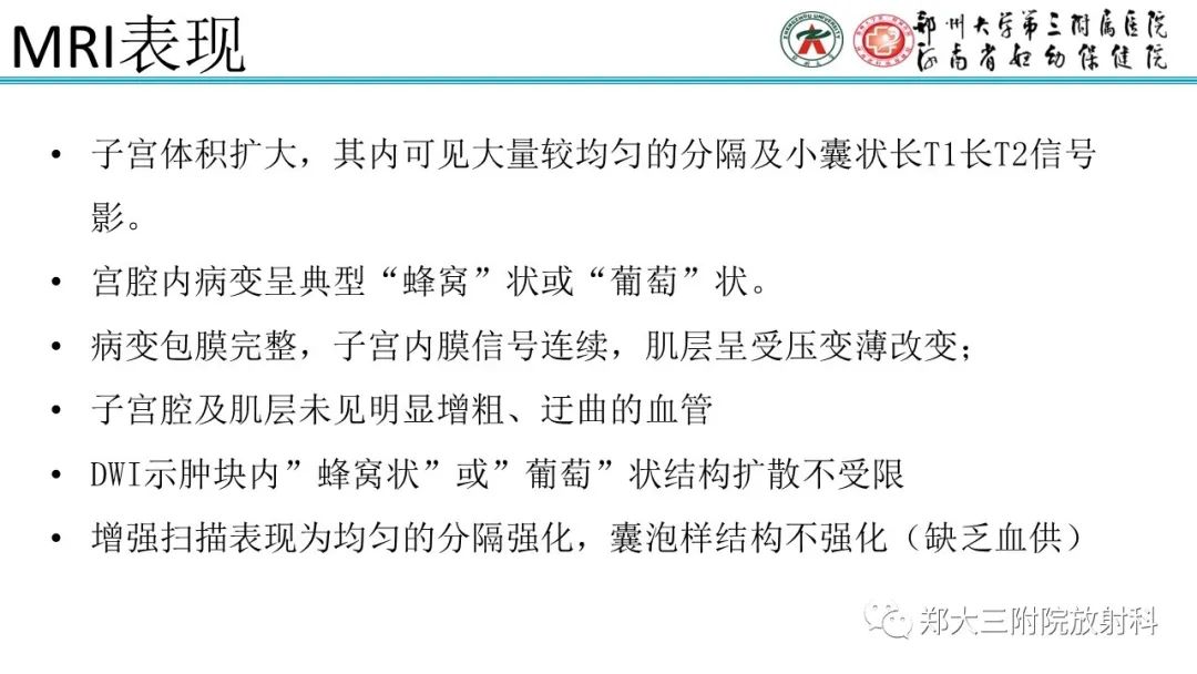 影像PPT - 【PPT】滋养细胞疾病的影像诊断-15