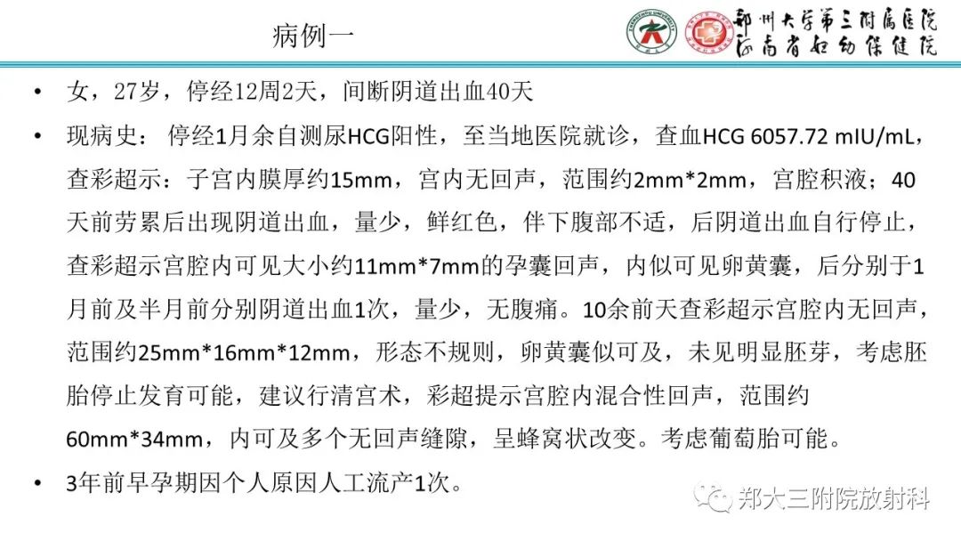 影像PPT - 【PPT】滋养细胞疾病的影像诊断-18