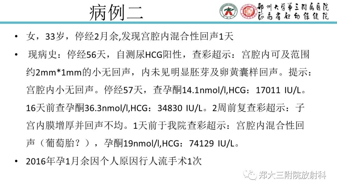 影像PPT - 【PPT】滋养细胞疾病的影像诊断-21