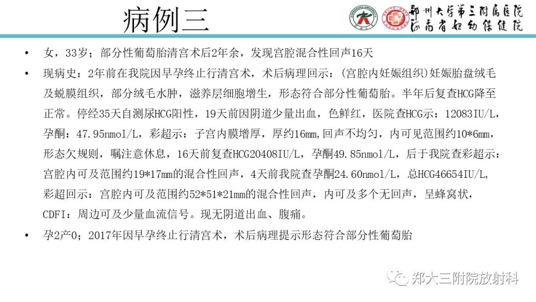 影像PPT - 【PPT】滋养细胞疾病的影像诊断-24