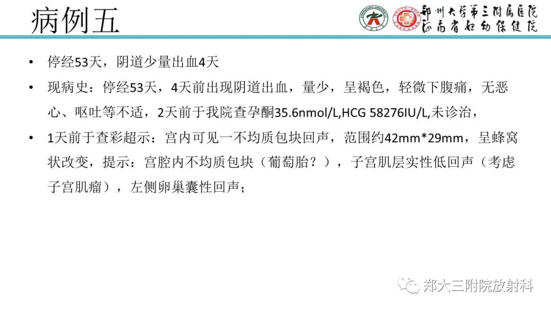 影像PPT - 【PPT】滋养细胞疾病的影像诊断-29