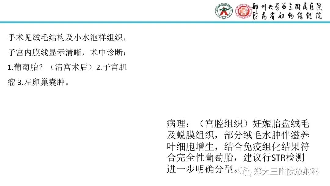 影像PPT - 【PPT】滋养细胞疾病的影像诊断-31