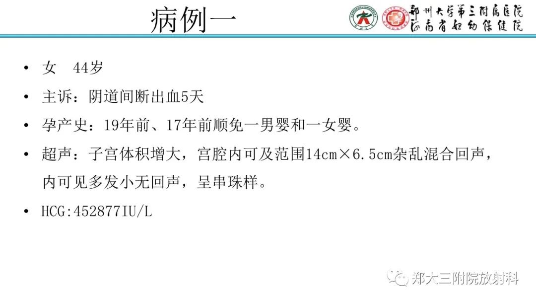 影像PPT - 【PPT】滋养细胞疾病的影像诊断-46