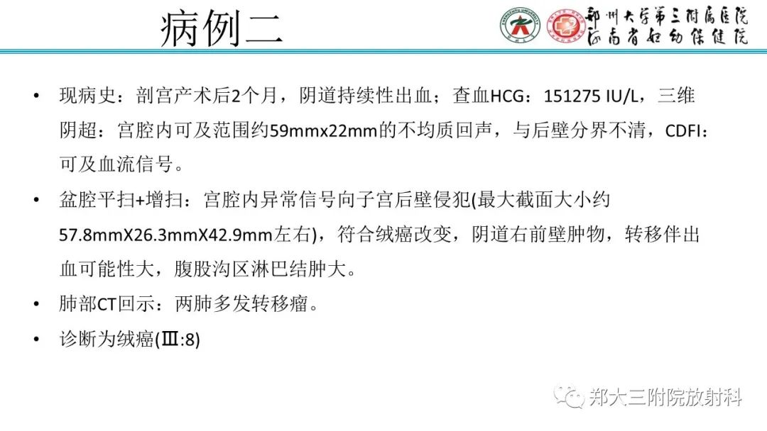 影像PPT - 【PPT】滋养细胞疾病的影像诊断-49