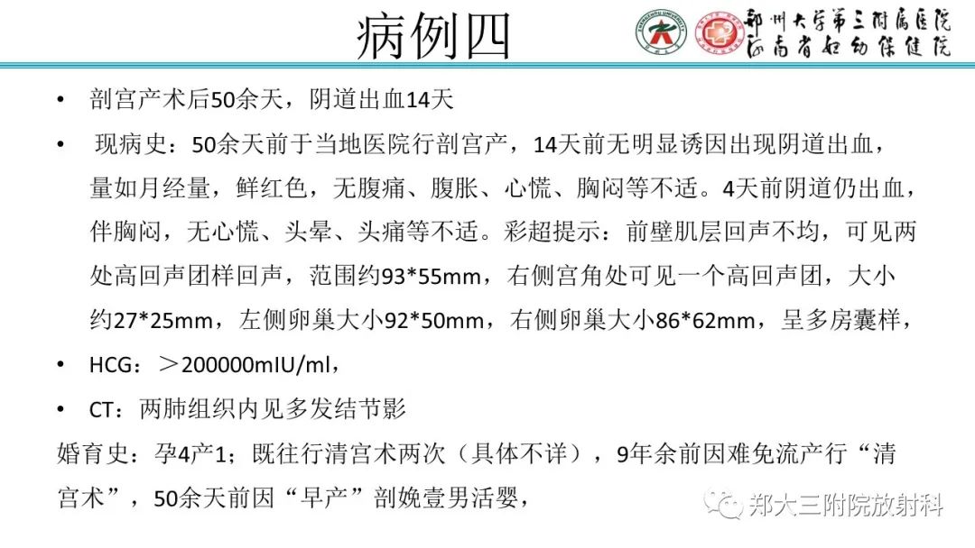 影像PPT - 【PPT】滋养细胞疾病的影像诊断-52