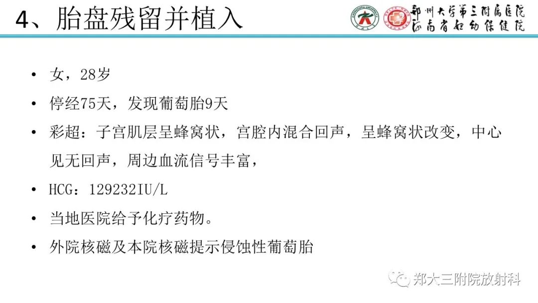 影像PPT - 【PPT】滋养细胞疾病的影像诊断-61