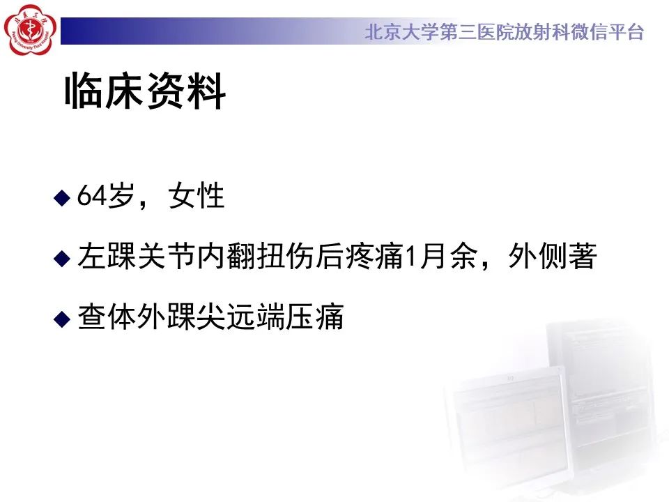 影像PPT - 【PPT】跗骨窦综合征-2