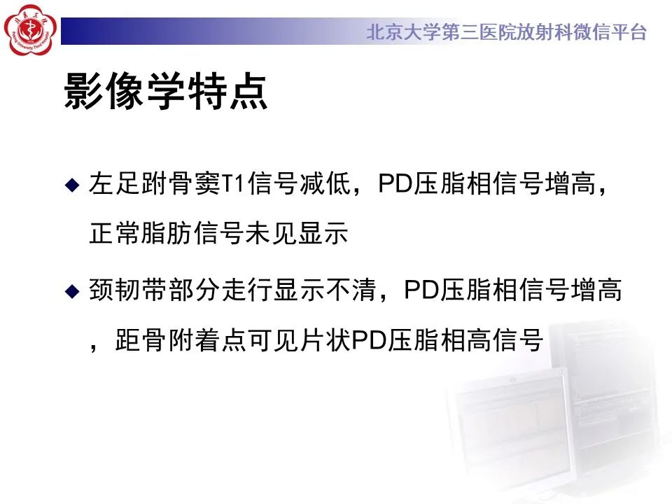 影像PPT - 【PPT】跗骨窦综合征-6