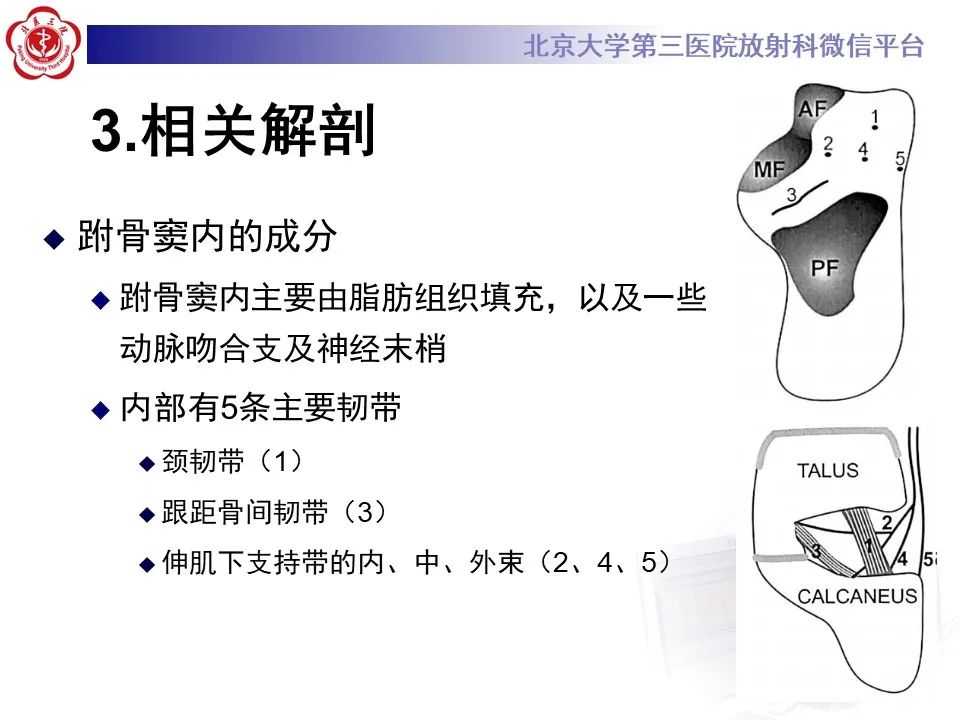 影像PPT - 【PPT】跗骨窦综合征-11