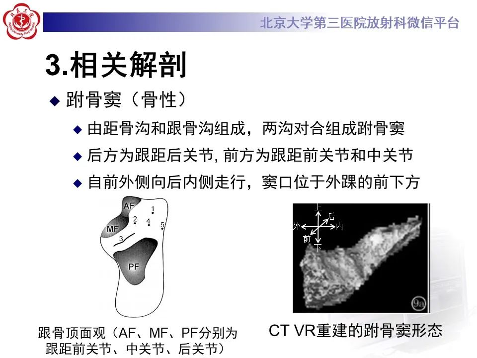影像PPT - 【PPT】跗骨窦综合征-10