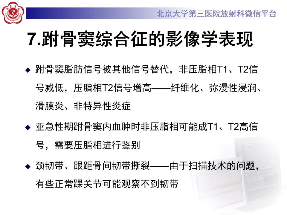 影像PPT - 【PPT】跗骨窦综合征-15