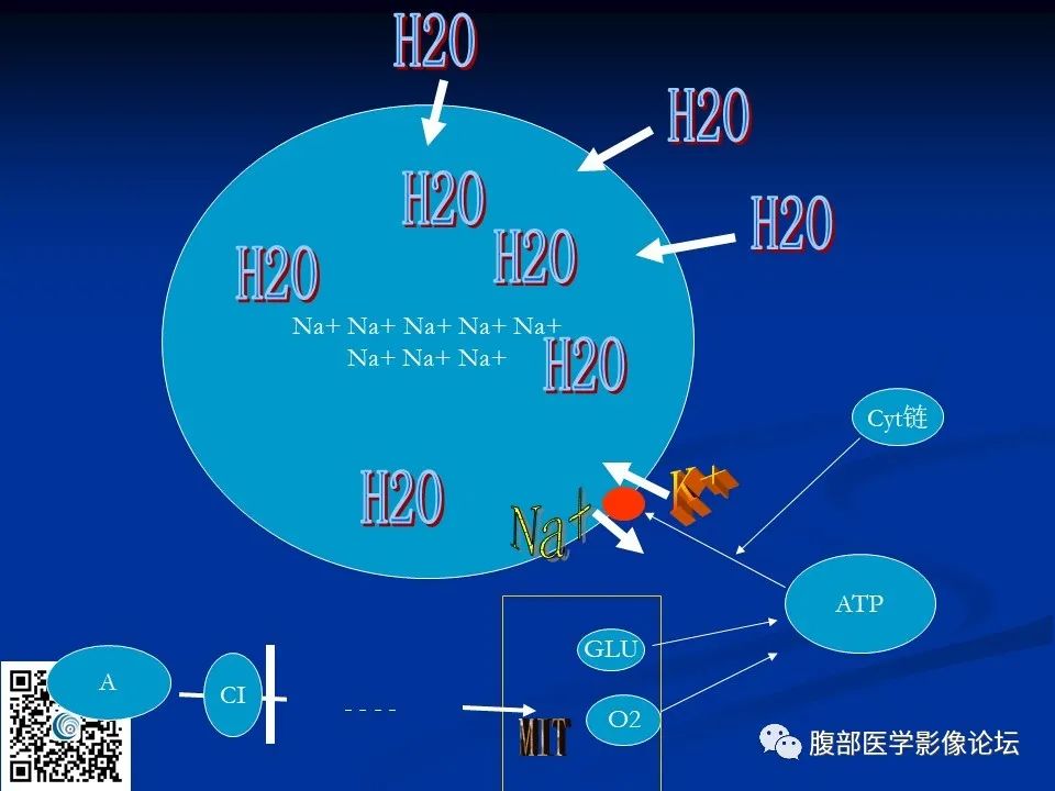 影像PPT - 【PPT】早期脑梗死MR诊断的一点体会-67