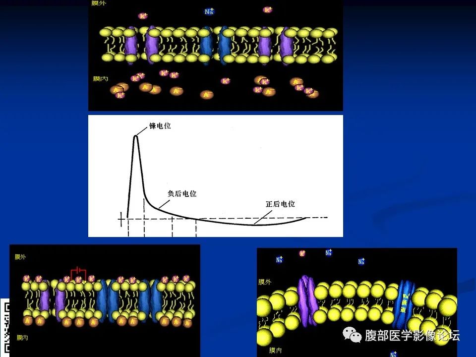 影像PPT - 【PPT】早期脑梗死MR诊断的一点体会-66