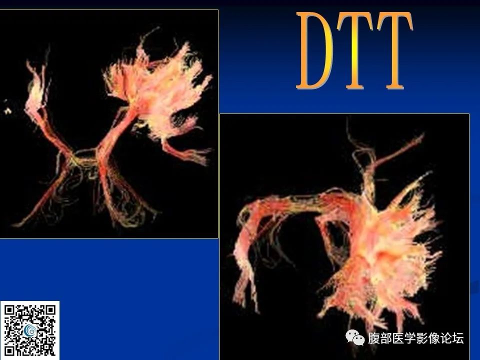 影像PPT - 【PPT】早期脑梗死MR诊断的一点体会-74