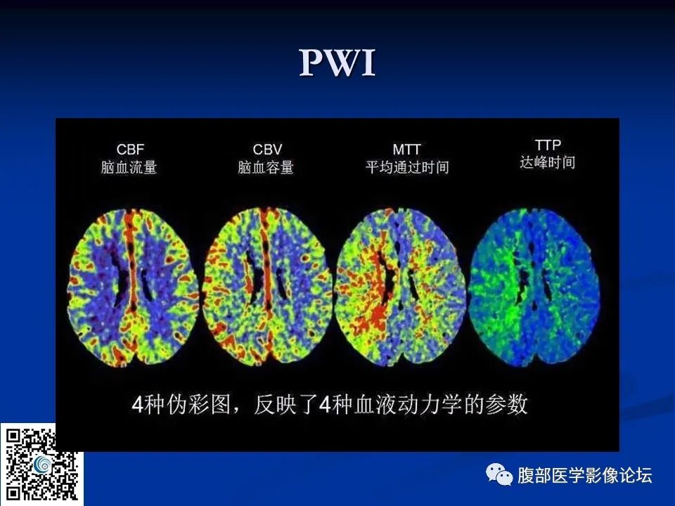 影像PPT - 【PPT】早期脑梗死MR诊断的一点体会-81