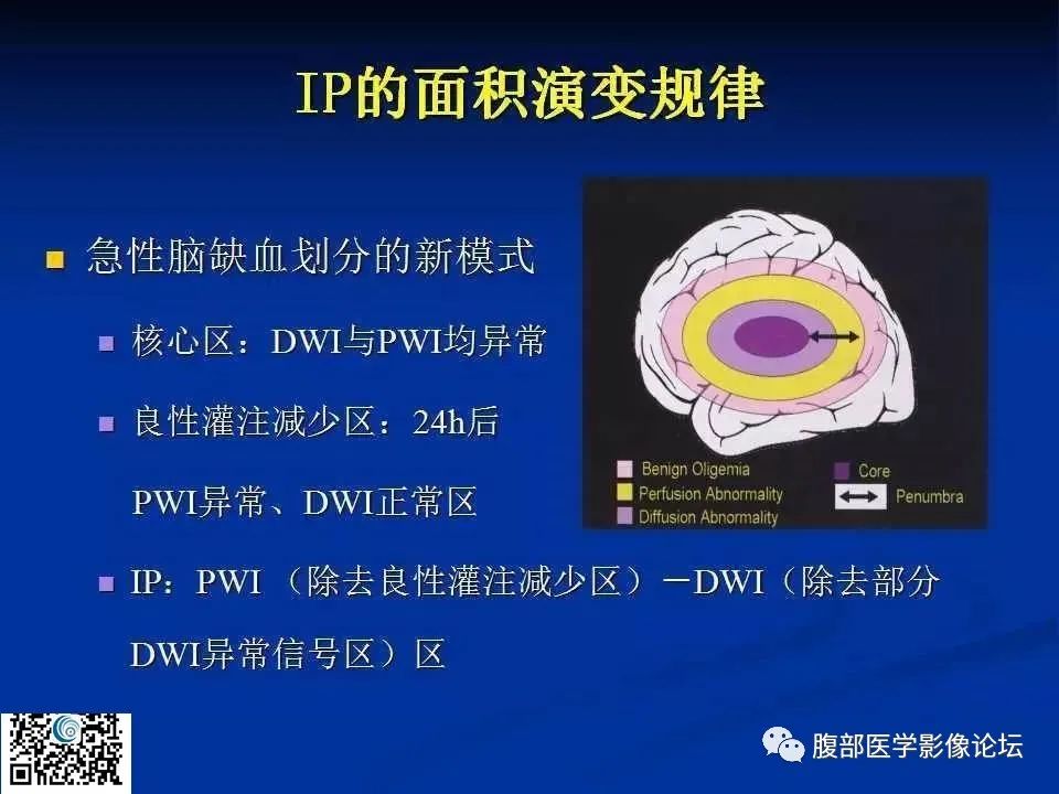 影像PPT - 【PPT】早期脑梗死MR诊断的一点体会-85