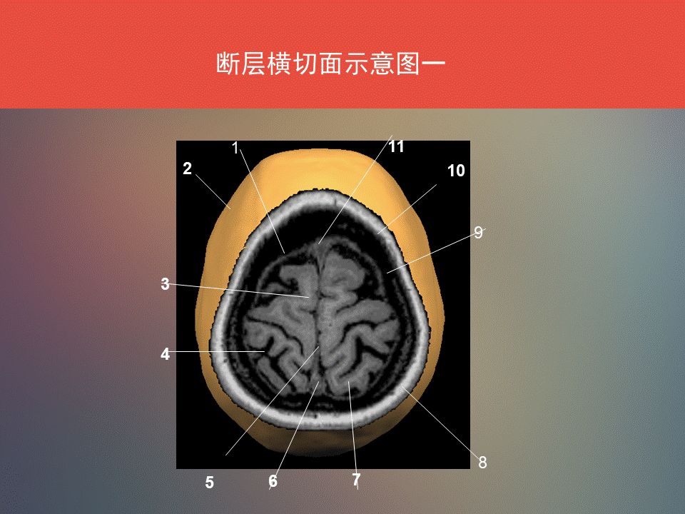 影像PPT - 脑功能区及解剖影像-3