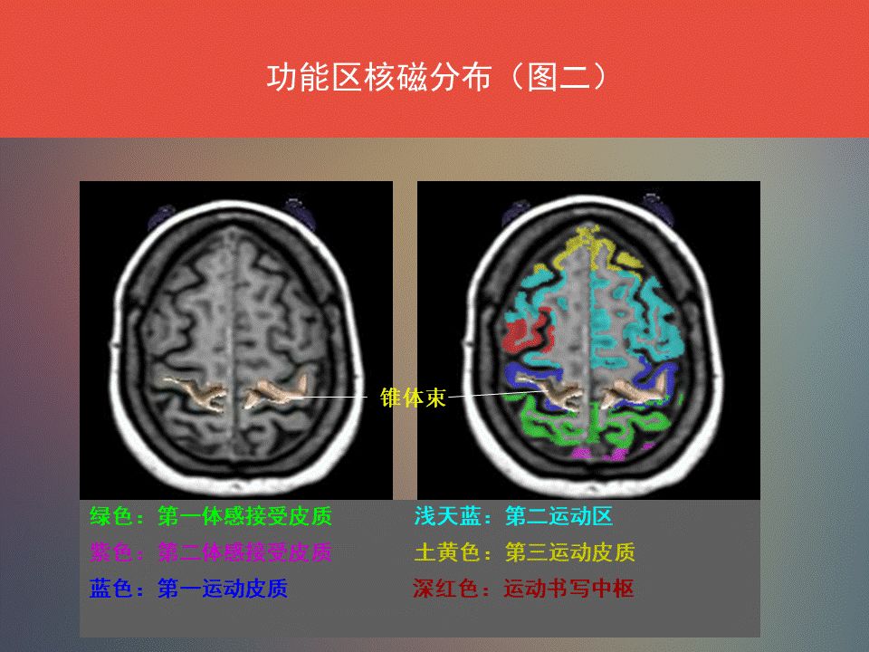 影像PPT - 脑功能区及解剖影像-7