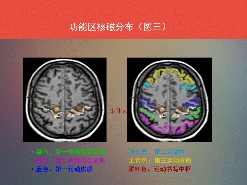 影像PPT - 脑功能区及解剖影像-10