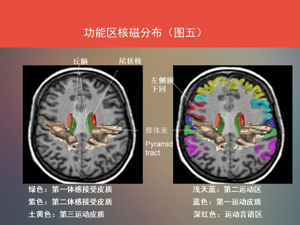 影像PPT - 脑功能区及解剖影像-15
