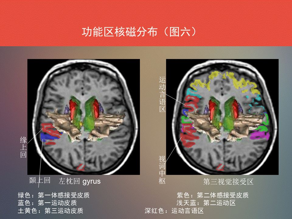 影像PPT - 脑功能区及解剖影像-18