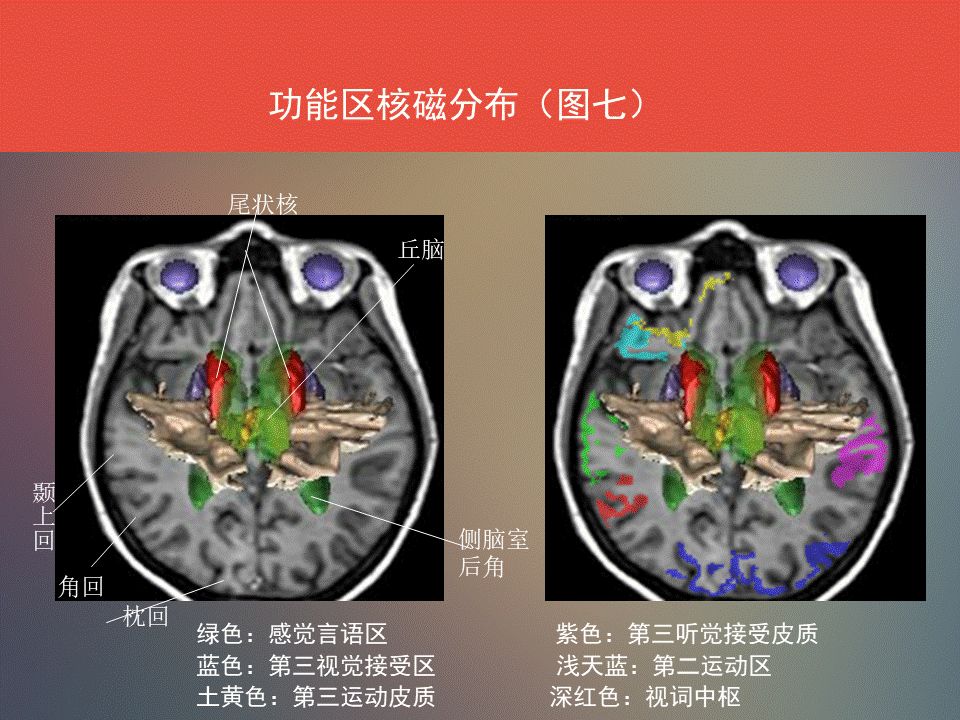 影像PPT - 脑功能区及解剖影像-21