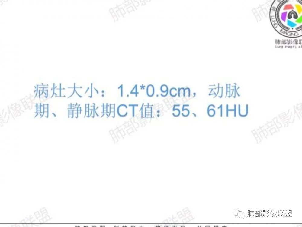 影像PPT - 【每日晨读】宽基底的胸膜下孤立结节你怎样决断?-4 影像PPT - 【每日晨读】宽基底的胸膜下孤立结节你怎样决断?-4
