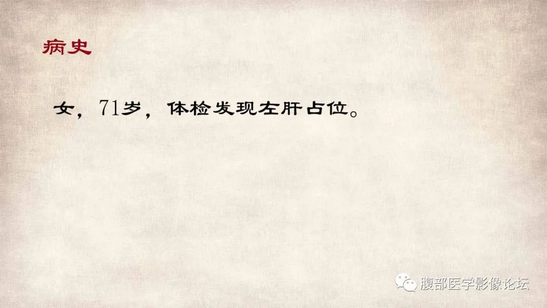 影像PPT - 【病例】肝脏硬化性血管瘤1例影像表现-2