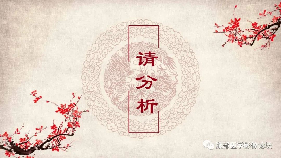 影像PPT - 【病例】肝脏硬化性血管瘤1例影像表现-9