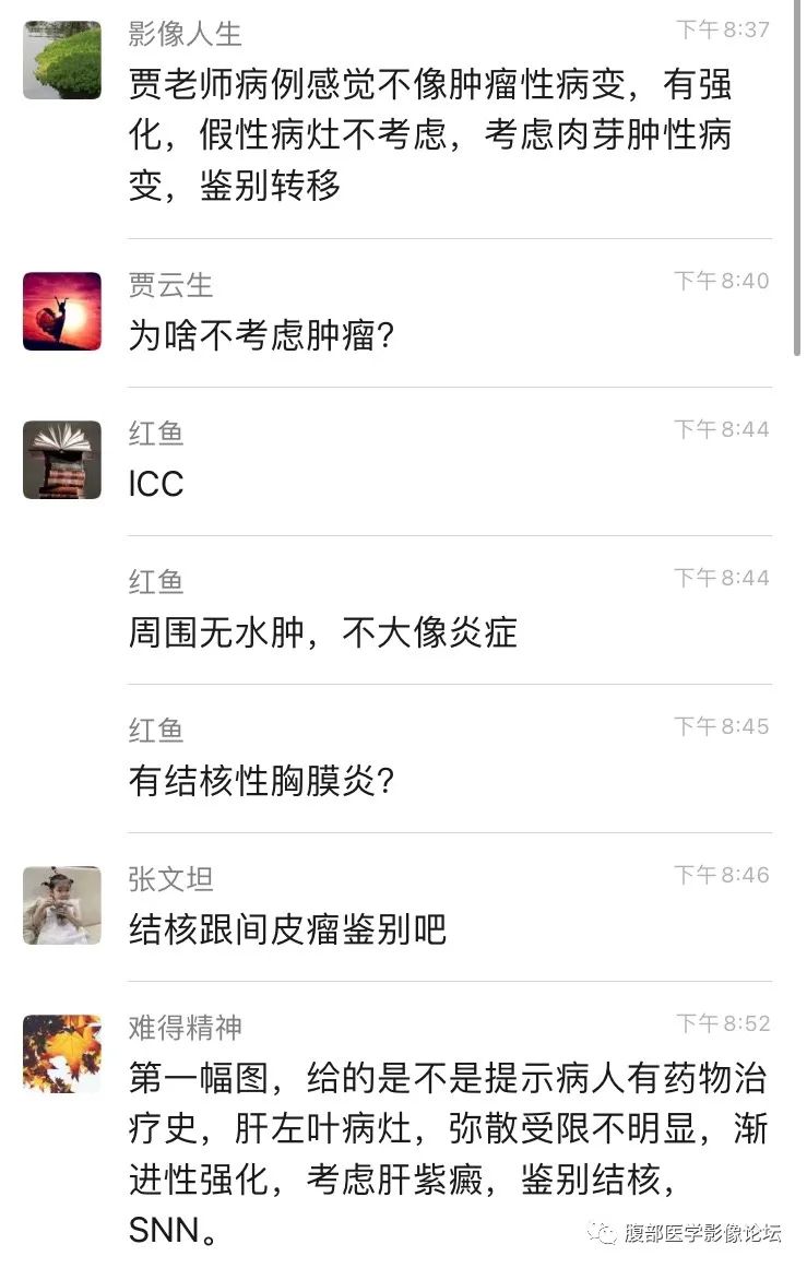 影像PPT - 【病例】肝脏硬化性血管瘤1例影像表现-11
