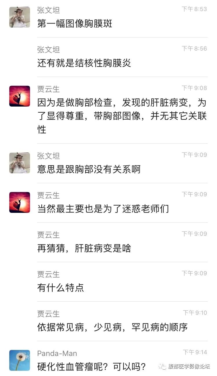 影像PPT - 【病例】肝脏硬化性血管瘤1例影像表现-12