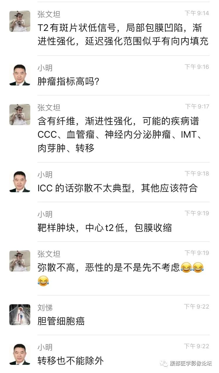 影像PPT - 【病例】肝脏硬化性血管瘤1例影像表现-13