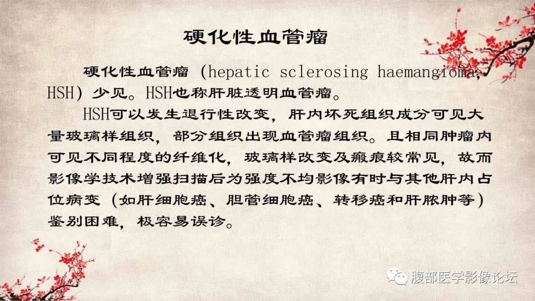 影像PPT - 【病例】肝脏硬化性血管瘤1例影像表现-18