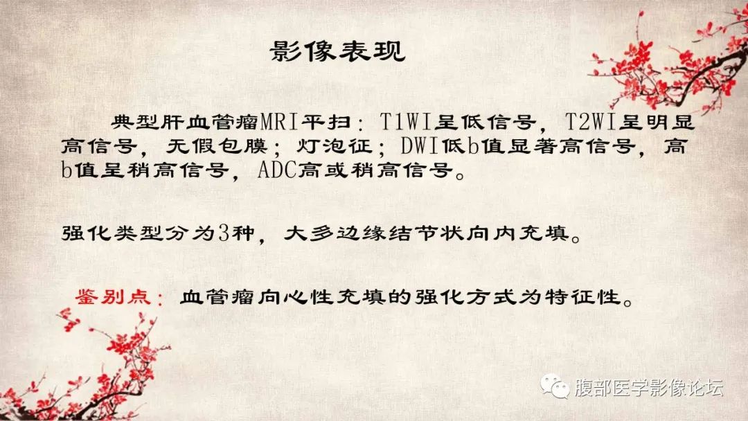 影像PPT - 【病例】肝脏硬化性血管瘤1例影像表现-19