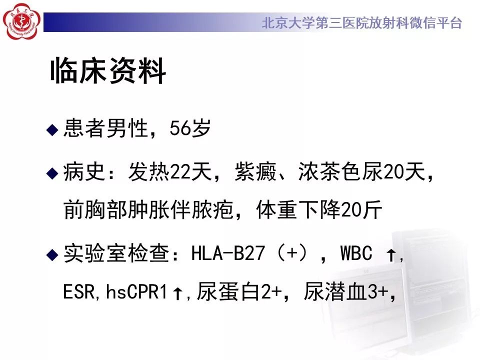 影像PPT - 【PPT】SAPHO综合征-2