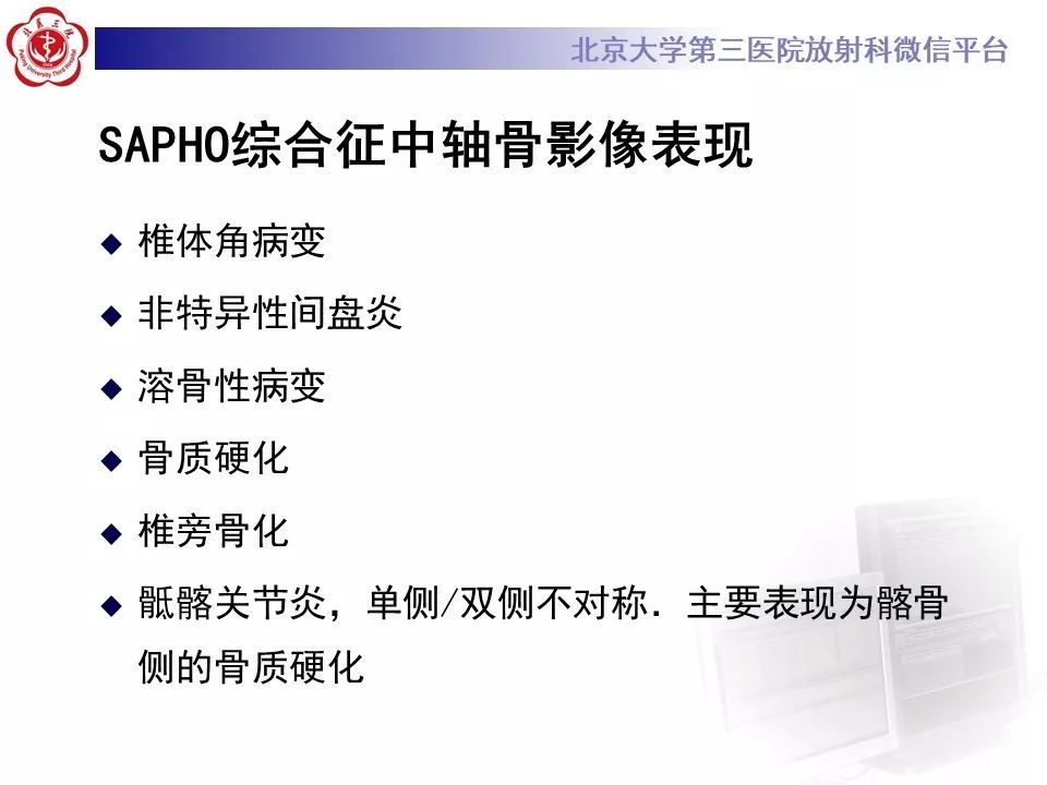 影像PPT - 【PPT】SAPHO综合征-18