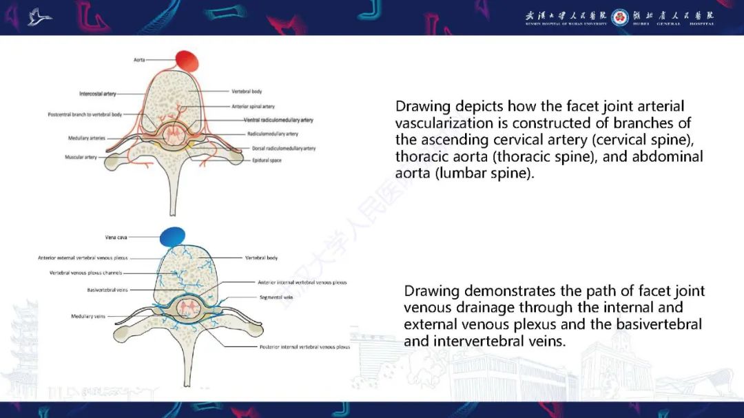 影像PPT - 【PPT】椎旁小关节病变影像诊断-6