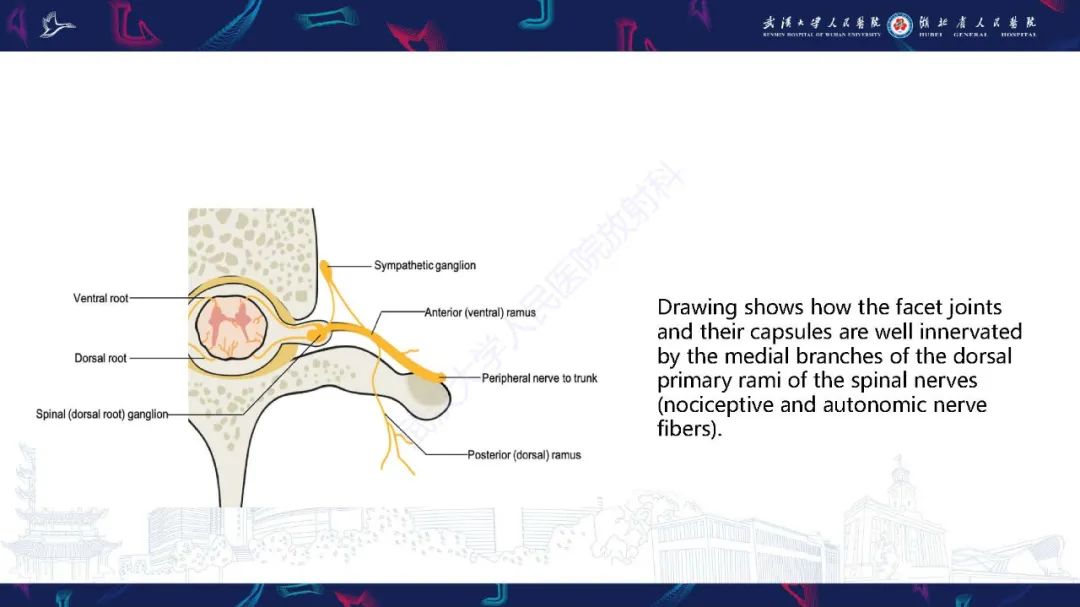 影像PPT - 【PPT】椎旁小关节病变影像诊断-7