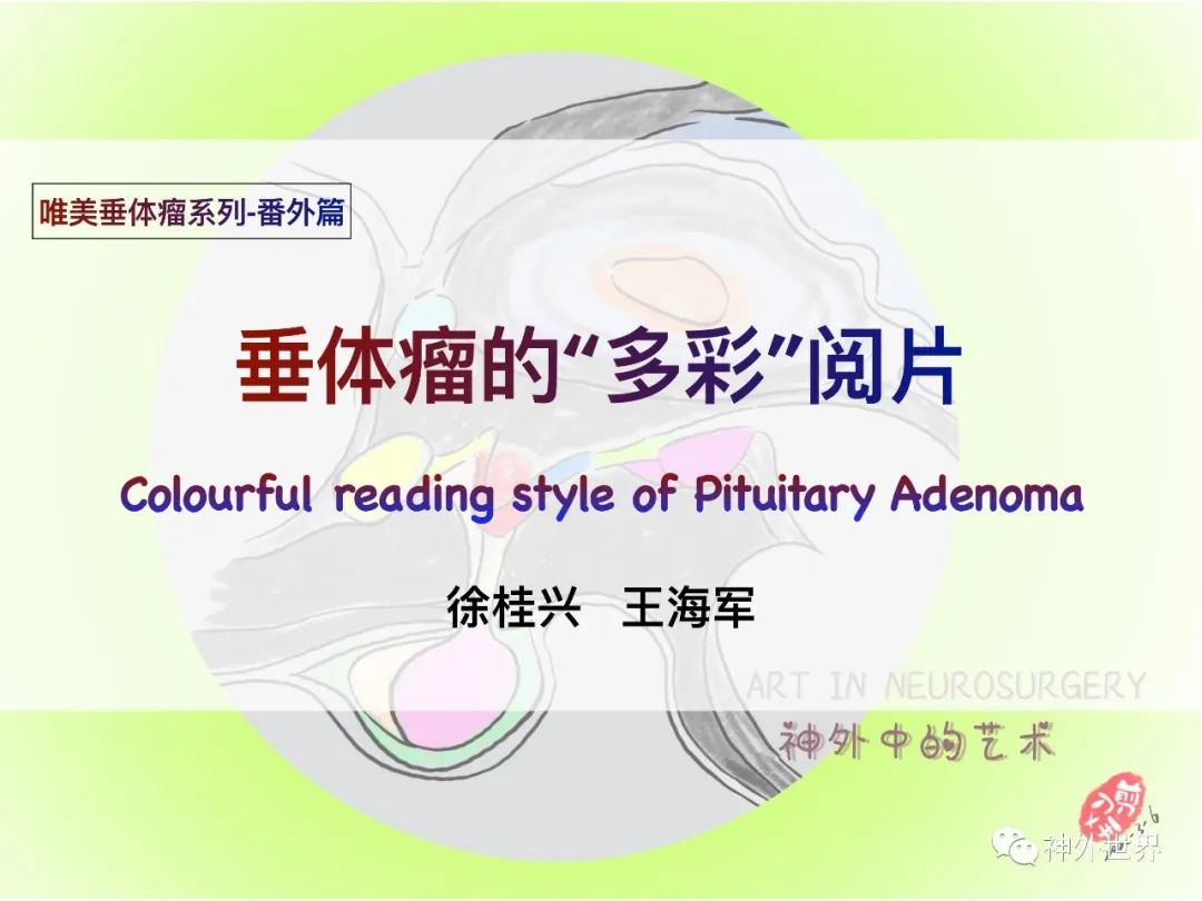 影像PPT - 【PPT】垂体瘤的多彩阅片-1