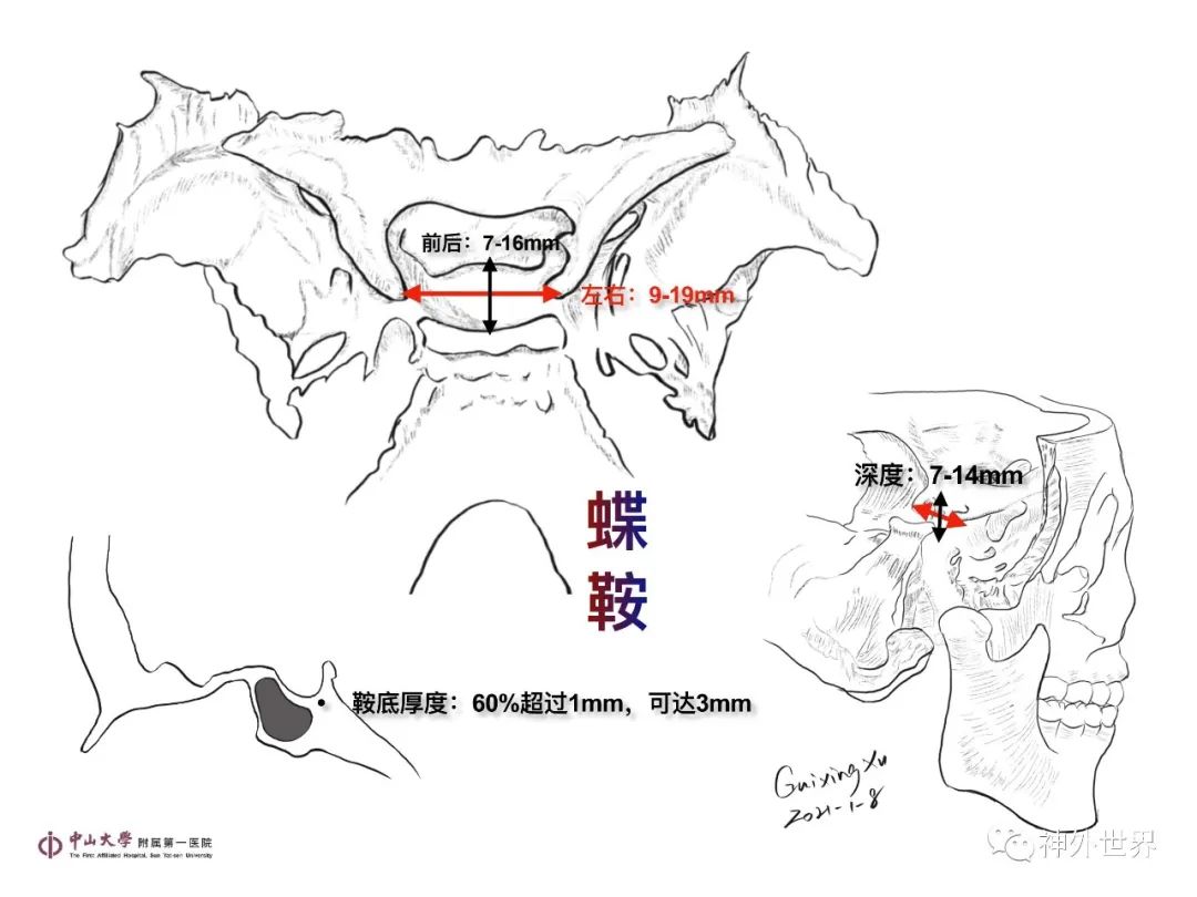 影像PPT - 【PPT】垂体瘤的多彩阅片-4