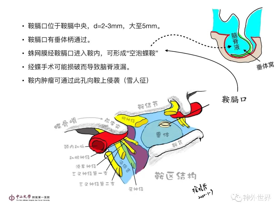 影像PPT - 【PPT】垂体瘤的多彩阅片-5