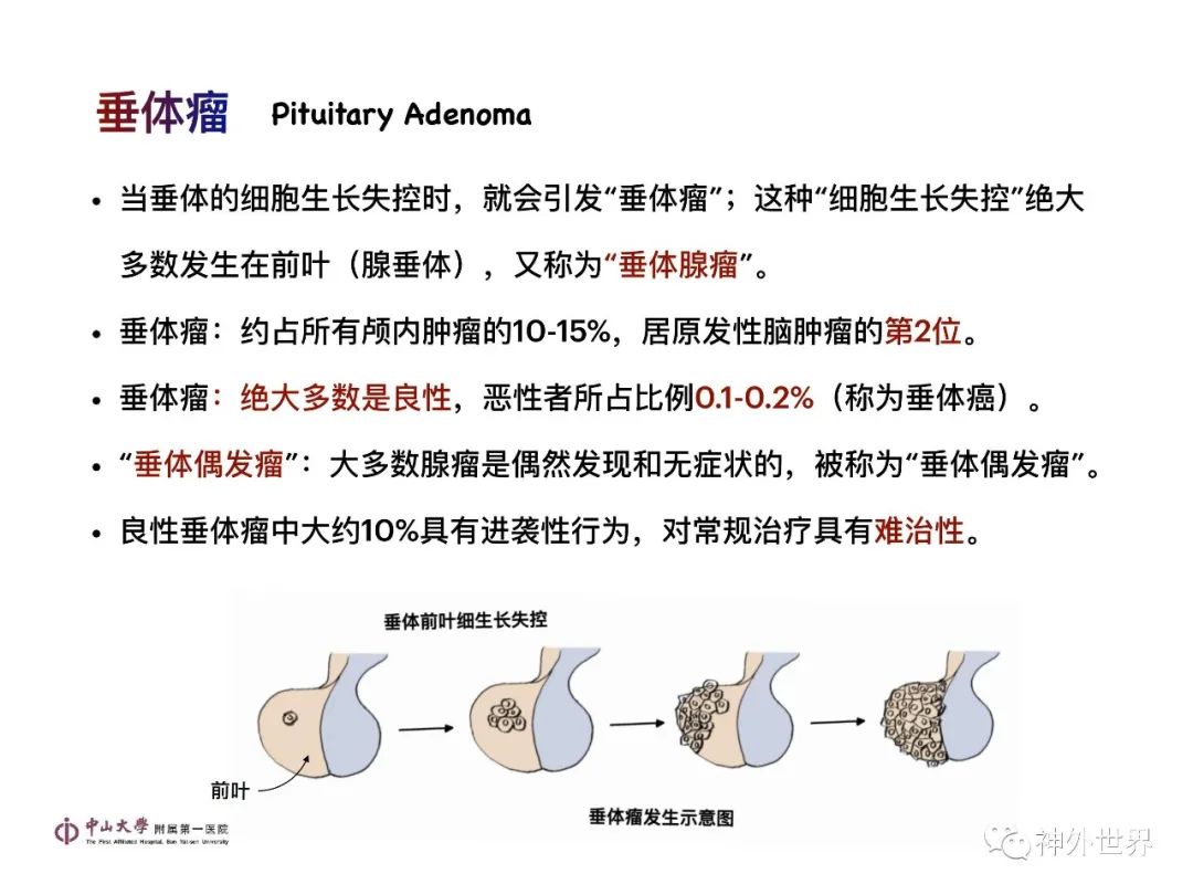 影像PPT - 【PPT】垂体瘤的多彩阅片-6