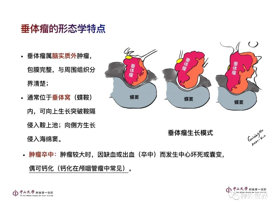 影像PPT - 【PPT】垂体瘤的多彩阅片-7