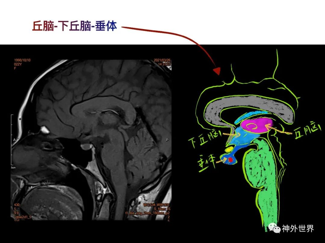 影像PPT - 【PPT】垂体瘤的多彩阅片-10